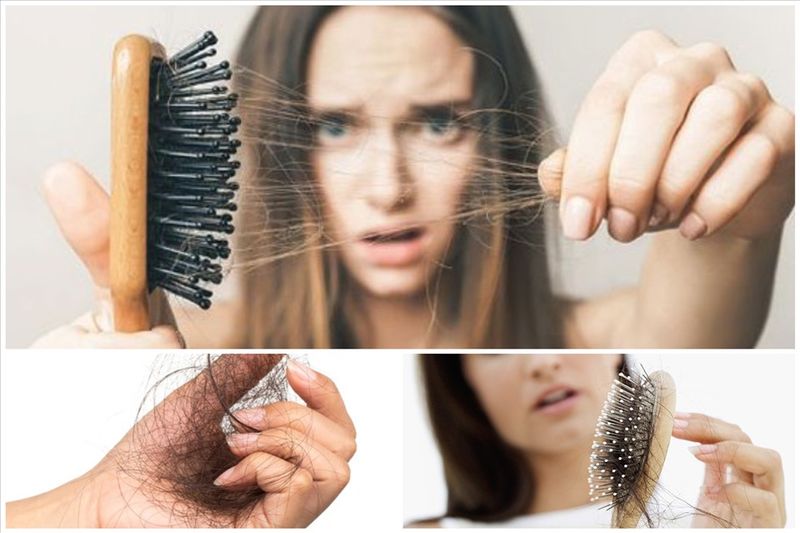 Nguyên nhân gây rụng tóc là gì