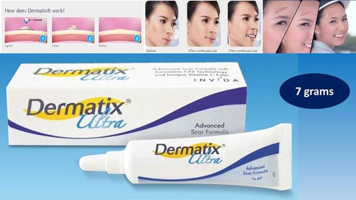 Thuốc điều trị sẹo Dermatix Ultra