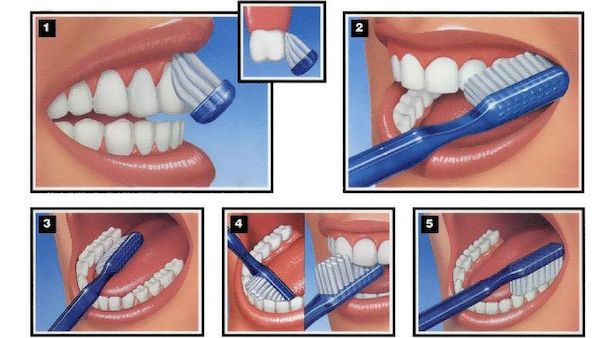 Giữ vệ sinh răng miệng sạch sẽ bằng cách đánh răng trước, sau khi đi ngủ và sau mỗi bữa ăn