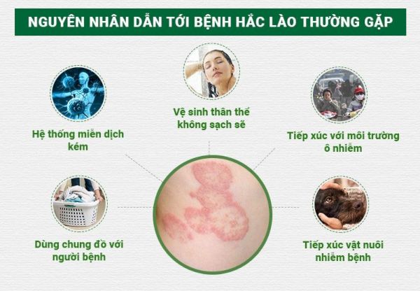 Hắc lào là một bệnh  truyền nhiễm do nấm gây ra