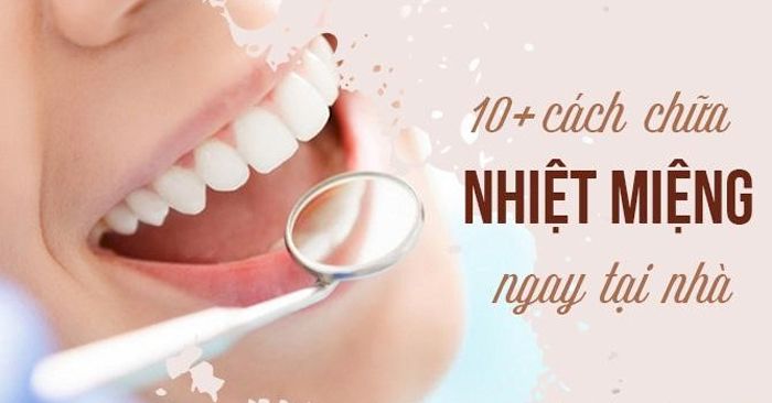 Một số cách chữa nhiệt miệng đơn giản tại nhà