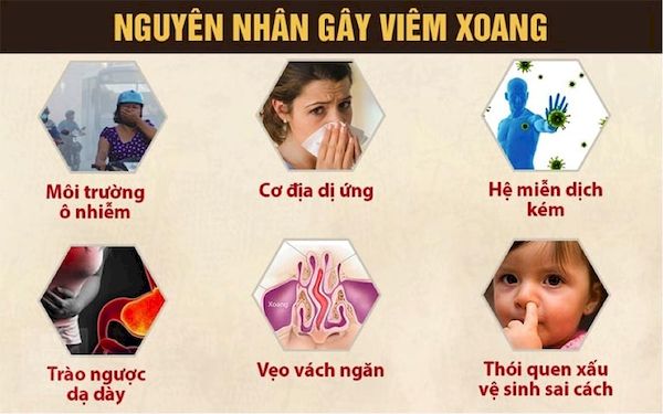 Nguyên nhân dẫn đến viêm xoang