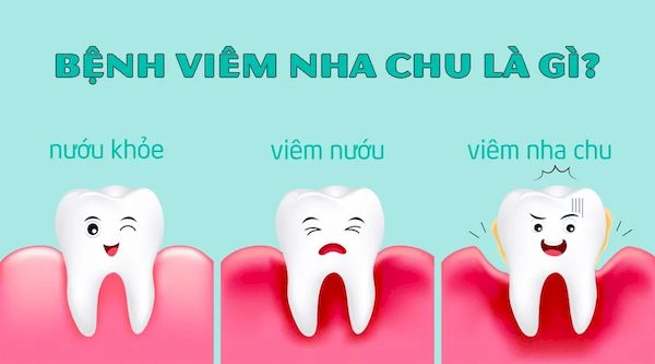 Nha chu là tổ chức xung quanh răng có chức năng nâng đỡ và lưu giữ răng trong xương.