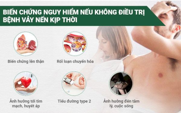 Những biến chứng nguy hiểm của bệnh vẩy nến