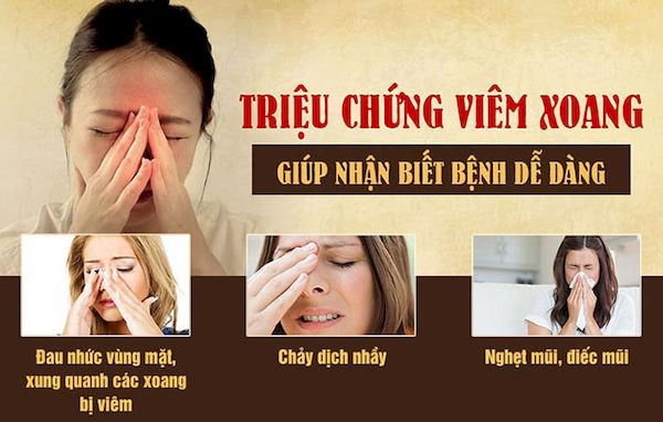 Đối với viêm xoang trước dịch mũi chảy ra mũi trước, còn viêm xoang sau, dịch mũi chảy xuống cổ họng Nghẹt mũi hoặc khó thở