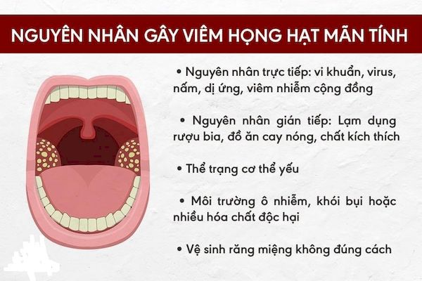 Về nguyên nhân gây nên viêm họng thì có rất nhiều