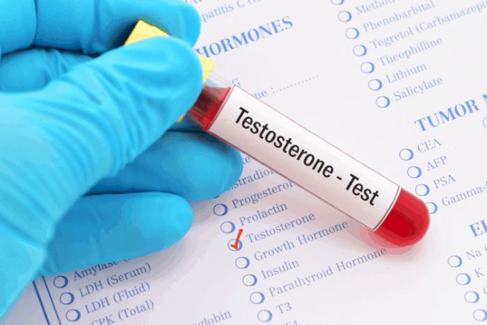 Chẩn đoán Testosterone thấp như thế nào