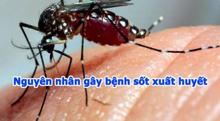 Nguyên nhân gây sốt xuất huyết