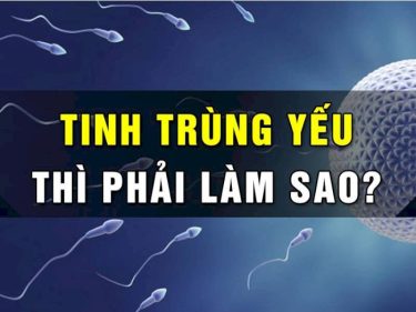 Tinh trùng là tế bào sinh sản của nam giới,. Các tinh trùng thường có kích thước khá nhỏ