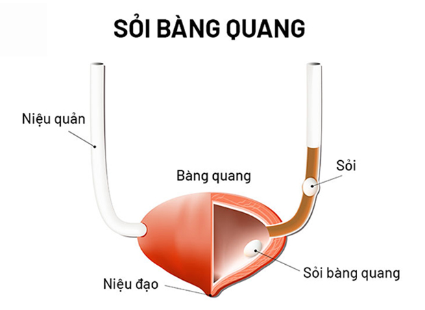 soi-bang-quang-1